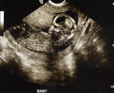 Baby01