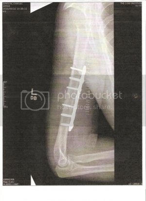 Arm3